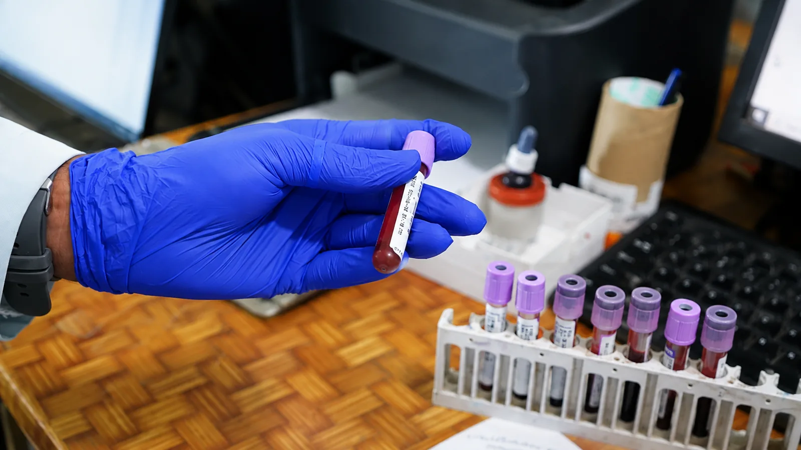 Aliquoting a barcoded sample